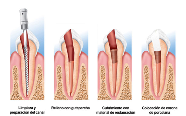 cirugia